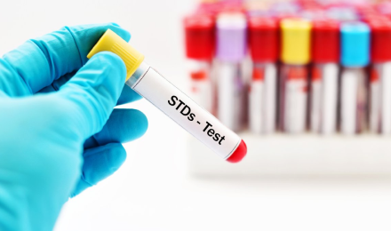 Confidential & Quick STI Testing With Reduced Fees For The Uninsured & Urgent Care Consultations Available